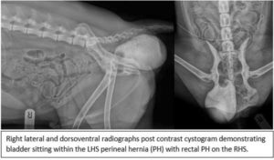 Bilateral Perineal Hernia with bladder retroversion.